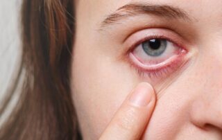 Eye irritation is a common condition and it can cause mild discomfort to serious medical complications. Here are the 7 common causes of eye irritation.