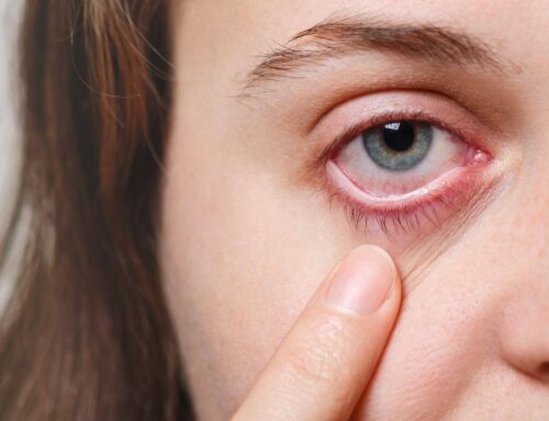 7 Common Causes of Eye Irritation and Ways To Fix Them