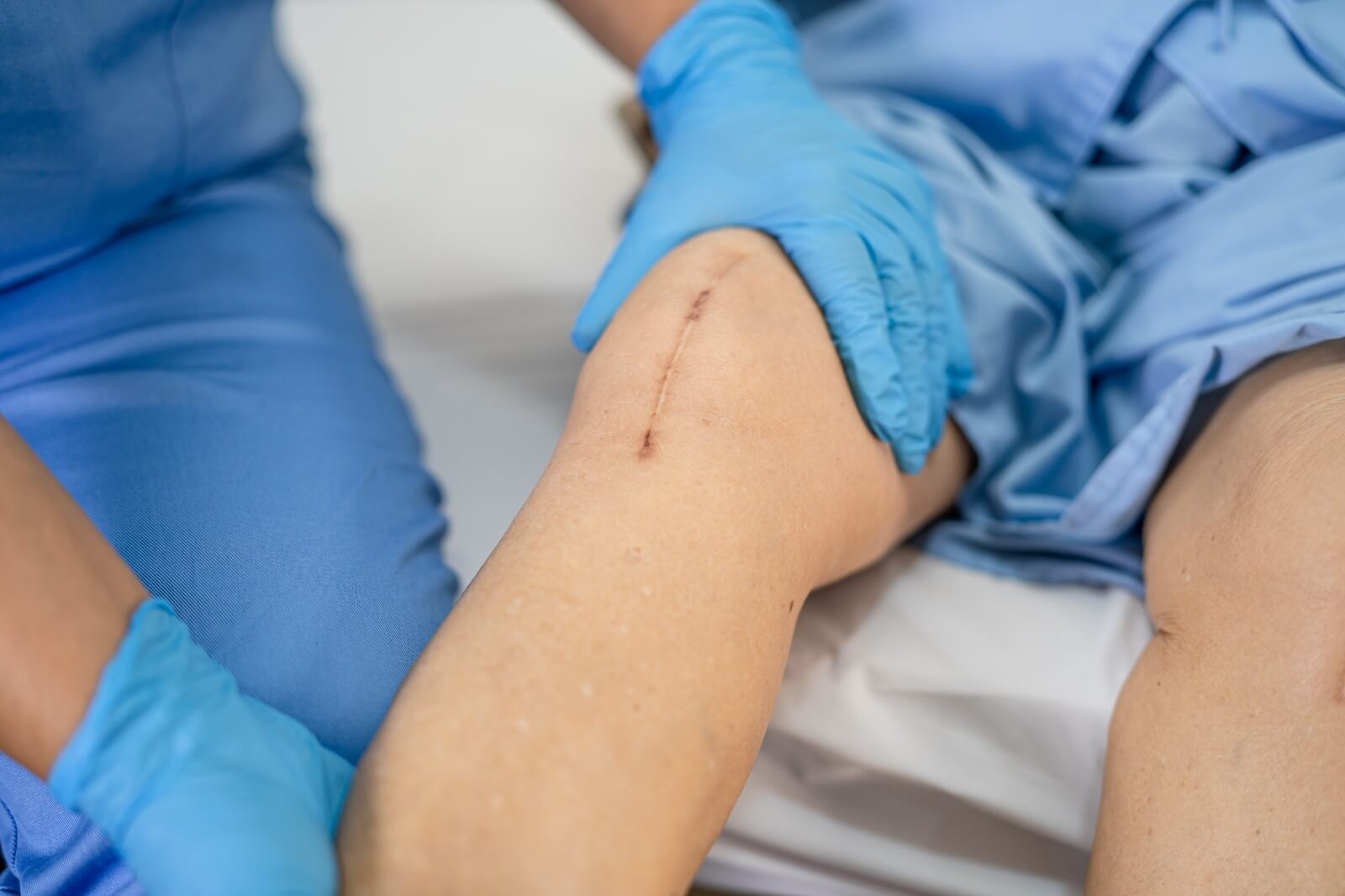 the fear of post-surgical pain shouldn’t stop anyone from seeking treatment for a better quality of life.